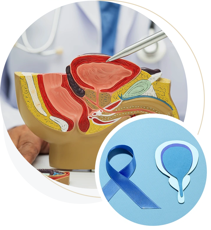 BladderCancer_img05
