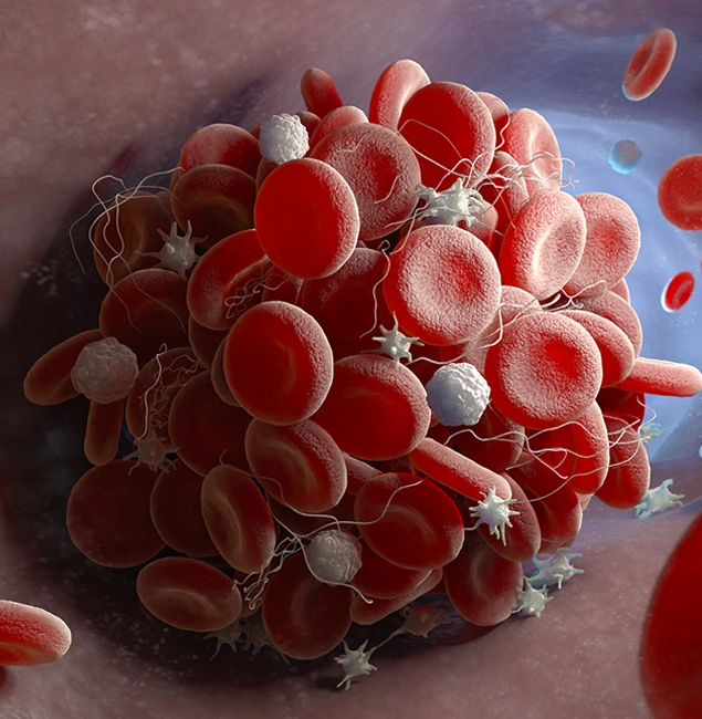 Blood&LymphaticCancers_img01