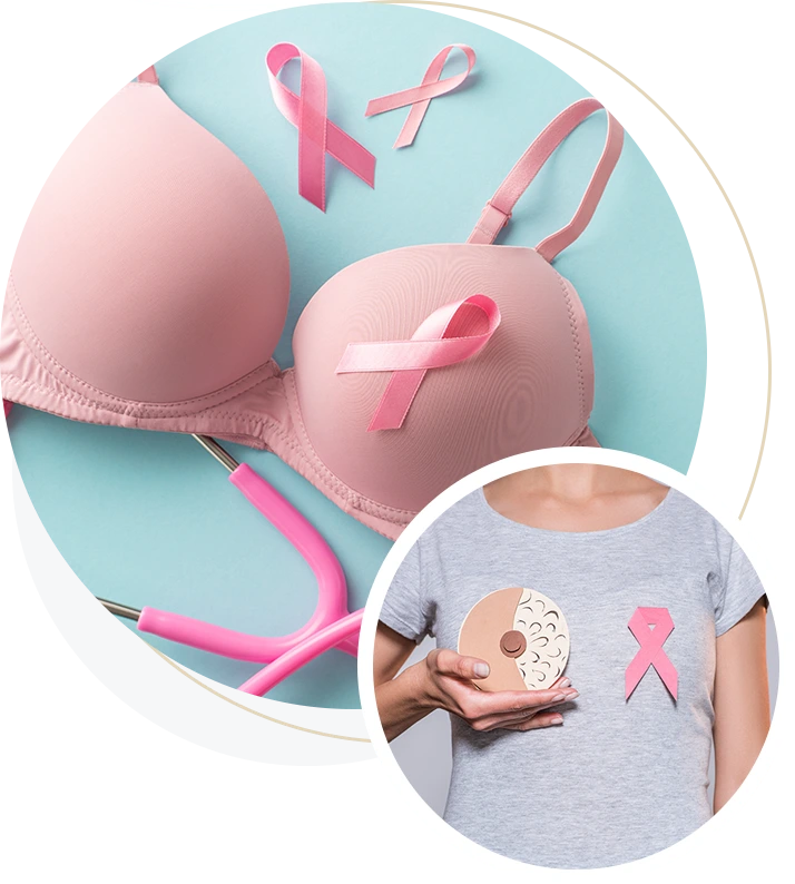 BreastCancer_img05