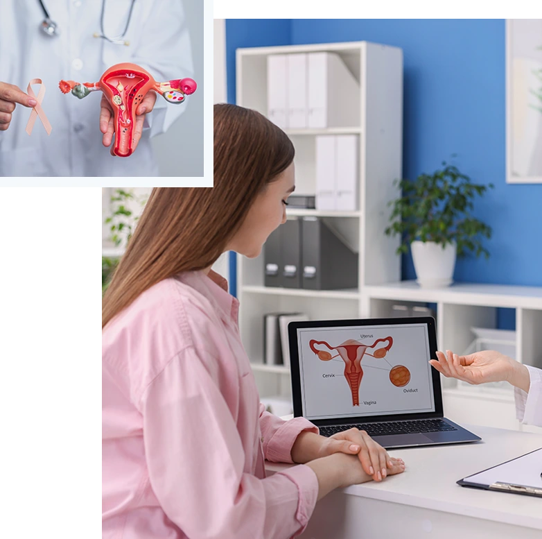CervicalCancer_img01