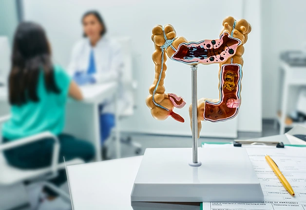 ColonCancer_img02
