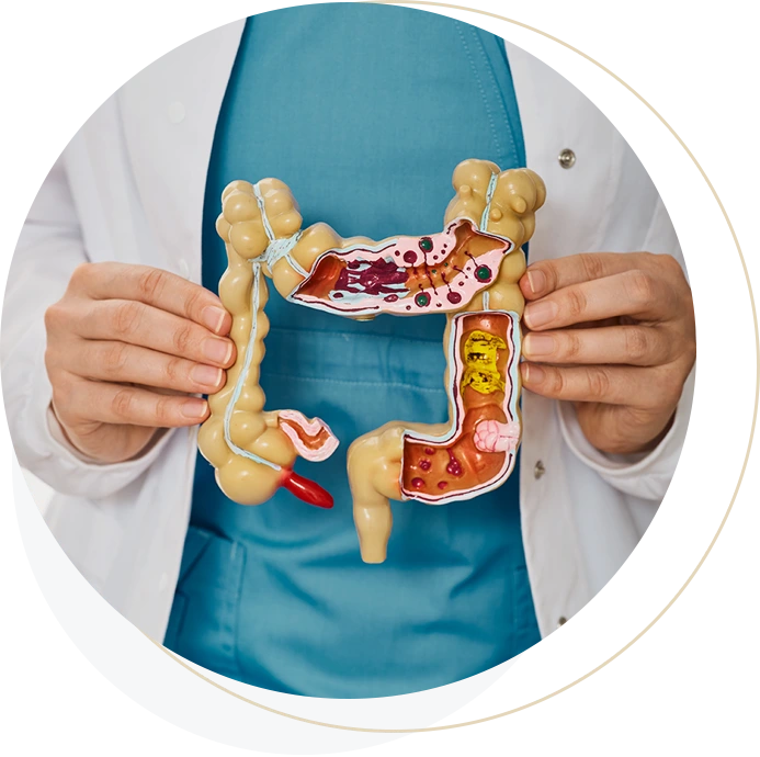 ColonCancer_img05