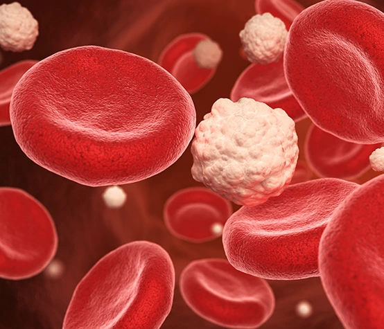 Leukemia_img02