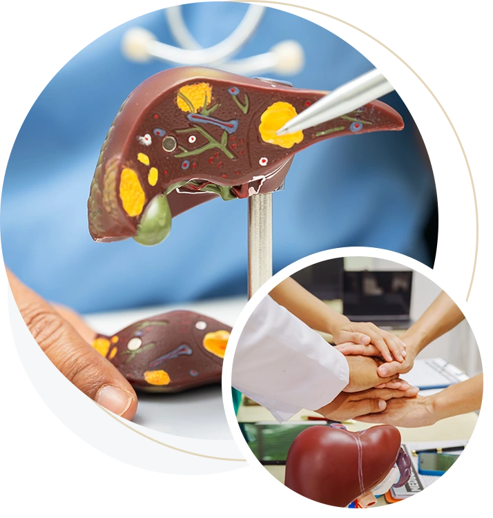 LiverCancer_img05