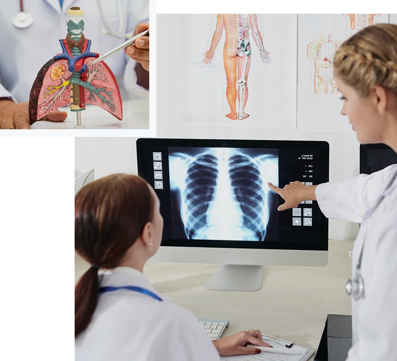 LungCancer_img01