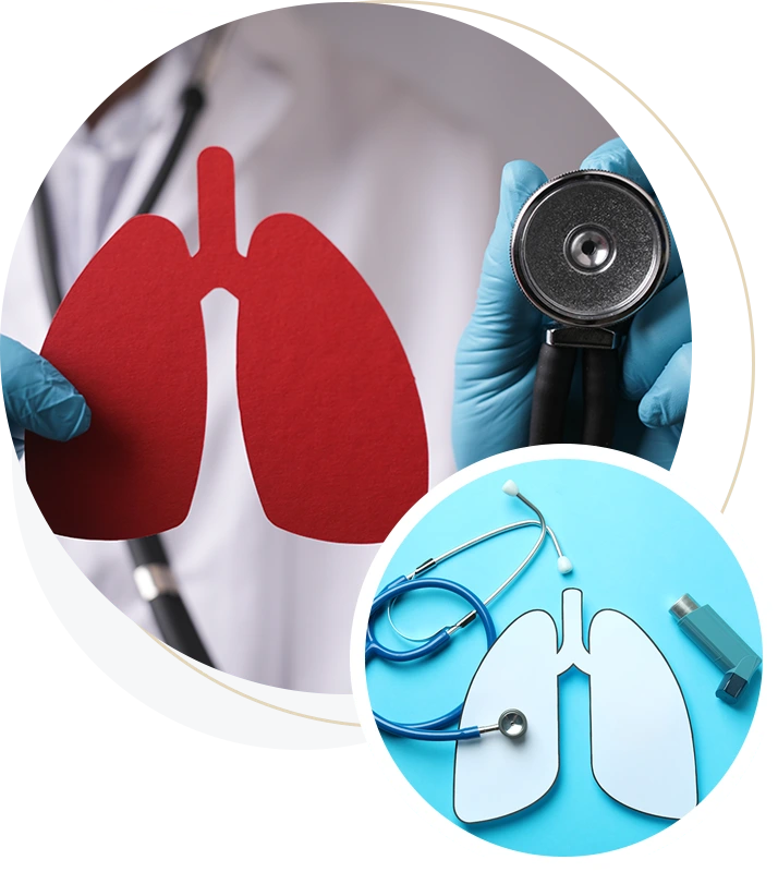 LungCancer_img05