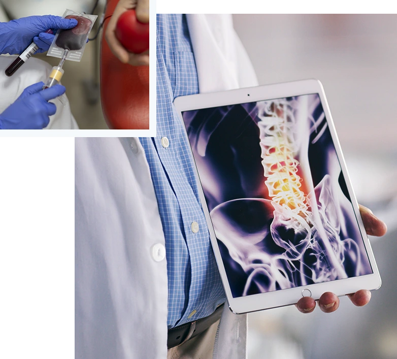 MultipleMyeloma_img01