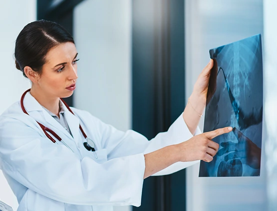 MultipleMyeloma_img02