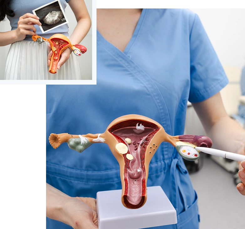 OvarianCancer_img01