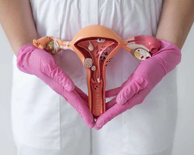 OvarianCancer_img02