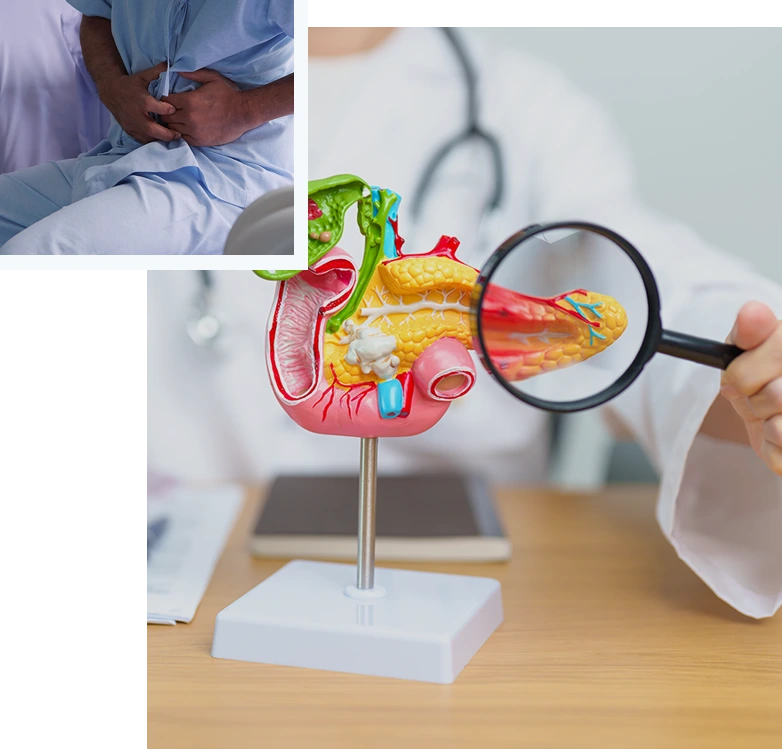 PancreaticCancer_img01