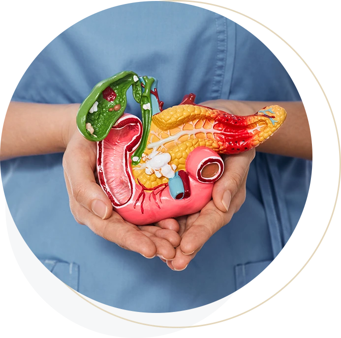 PancreaticCancer_img05
